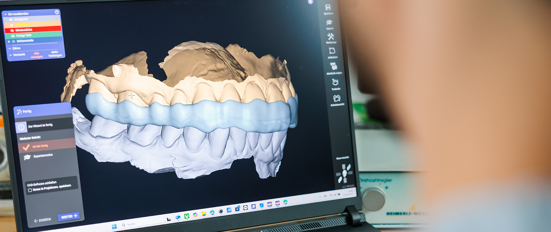 3D-Zahnbogen auf Bildschirm